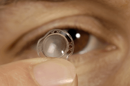 Image: A new artificial cornea developed from a commercial polymer (photo courtesy Fraunhofer Institute).